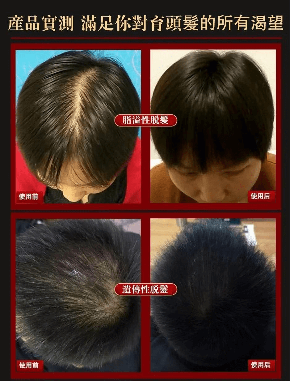 茜妃防脫育髮液仁德育草堂防脫育髮精華液1709362947212491.png 茜妃防脫育髮液