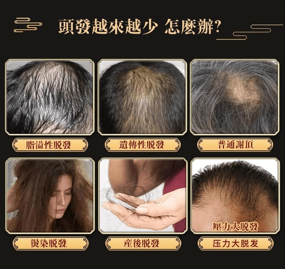 茜妃防脫育髮液1709362947500517.png 茜妃防脫育髮液