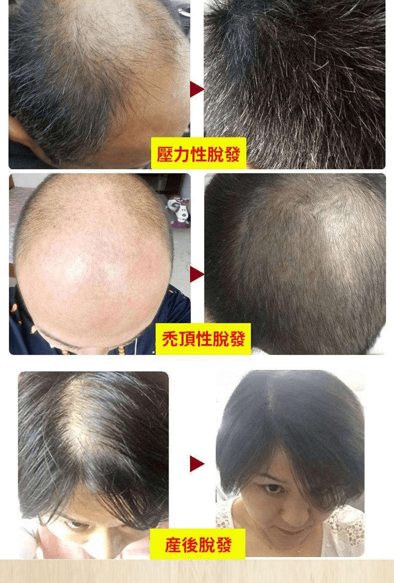 茜妃防脫育髮液1709362947704770.png 茜妃防脫育髮液