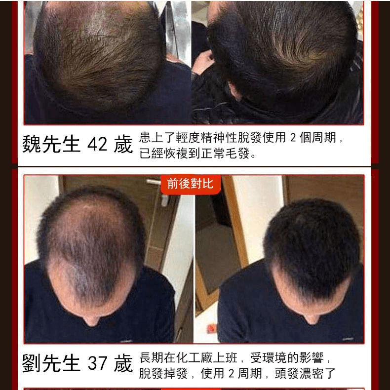 茜妃防脫育髮液1709362947792029.png 茜妃防脫育髮液