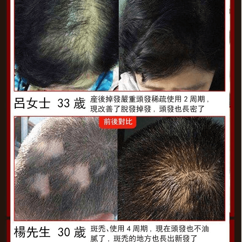 茜妃防脫育髮液仁德育草堂防脫育髮精華液1709362947819096.png 茜妃防脫育髮液